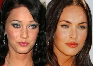 25 Celebrities Before And After Plastic Surgery