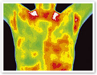 Thermography