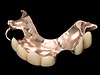 Winston Churchill gold teeth