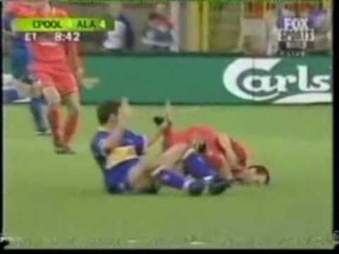 Liverpool-Deportivo Alaves 2001 UEFA Cup Final.wmv