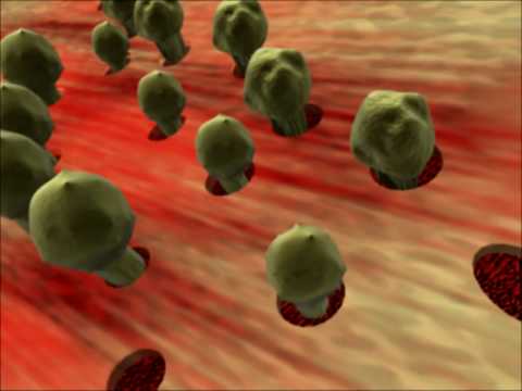 Johns Hopkins Medicine: Aplastic Anemia