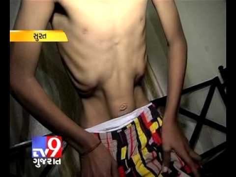 TV9 Gujarat - Rubber Boy surat