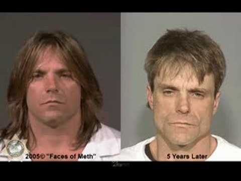 Faces of Meth Before And After Mug Shots - Educational Video