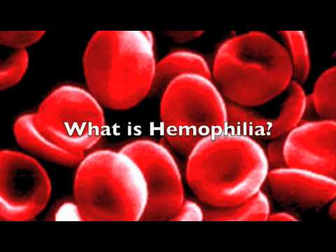 Hemophilia The Royal Disease