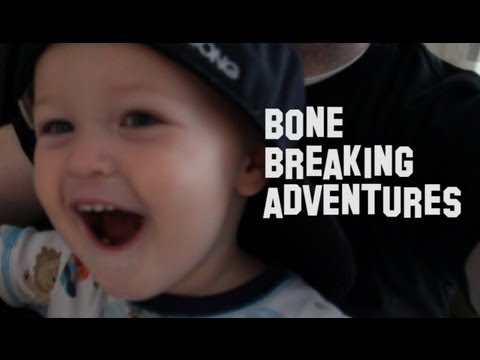 Bone Breaking Adventures in California