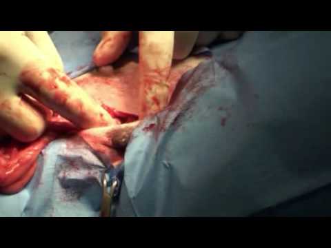 Veterinary Surgery:Spaying a Female Dog