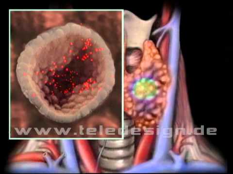 HBD 007 Schilddrüse / thyroid gland SD/PAL