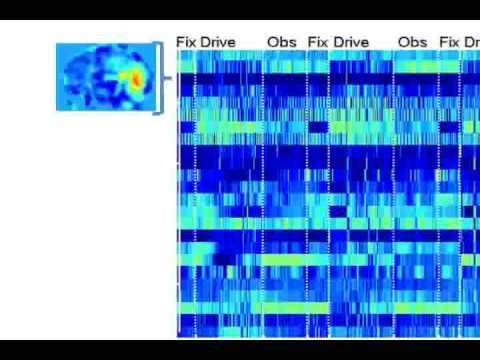 brainmusic: fmri into musical sound