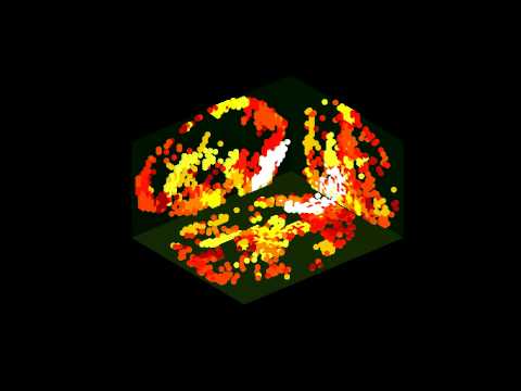 Intermezzo: Brainmusic in fMRI time