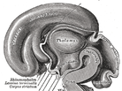 A fatty diet may trigger inflammation of the hypothalamus, deep inside the brain, and hinder weight loss.