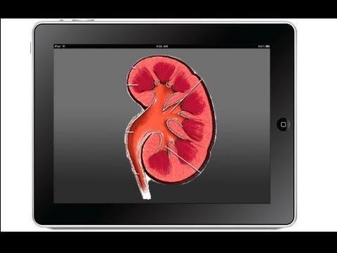 Kidney Traded for iPad2