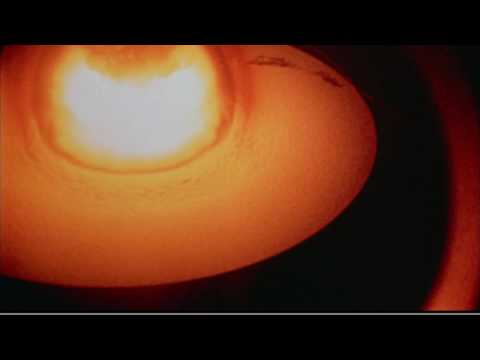 Castle Bravo - huge thermonuclear Explosion