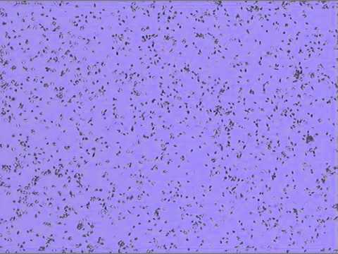 Human sperm evaluation (semen analysis), Fertility Specialists of Texas.avi