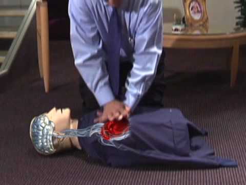 Continuous Chest Compression CPR—University of Arizona Sarver Heart Center