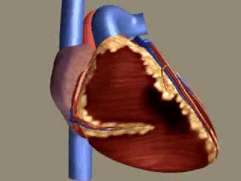 Myocardial Infarction