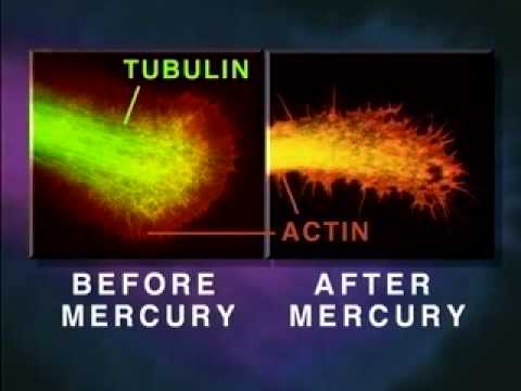 Neuro-Toxin - Mercury Melts Your Brain