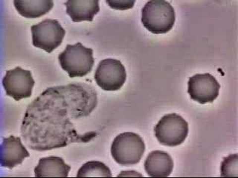 White Blood Cell Chases Bacteria