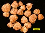 Rhynchotrema dentatum, a rhynchonellid brachiopod from the Cincinnatian (Upper Ordovician) of southeastern Indiana.