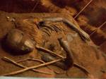 Bog body