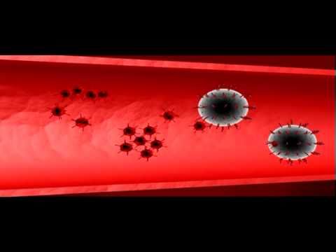 HIV destroys helper T-cells | Biology | Anatomy | Immunology