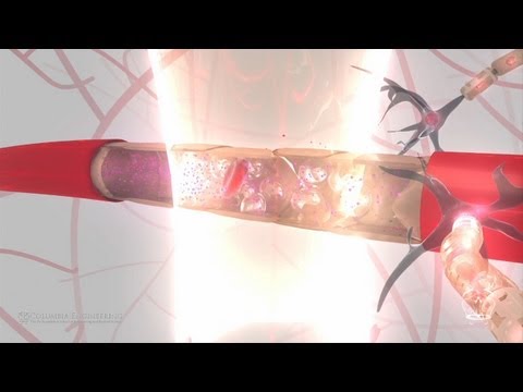 Columbia Engineering / Research - Elisa Konofagou - Blood Brain Barrier Animation