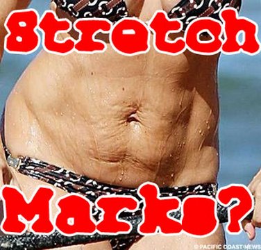 Vanish Stretch-Marks For FREE! TonyaTko Tutorial All Natural Shea Butter Secret