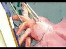 Colossal Squid