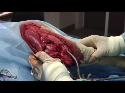 Cruciate Ligament Rupture In Dogs (2): Surgical Repair