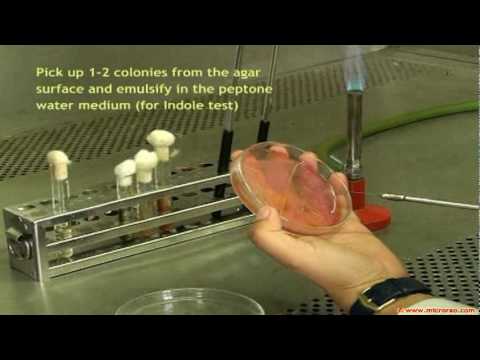 TSI reaction, Urea hydrolysis, Citrate utilization and Indole test