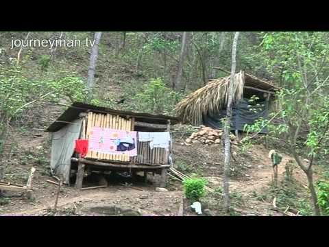 Syphilis Laboratory - Guatemala