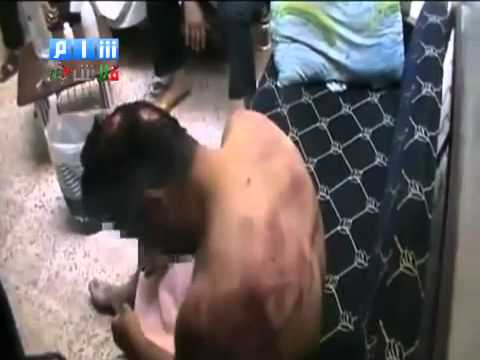 18+ Syria -Torture Beating Victim of Dictator Assad's Security Forces - Midan Damascus - 8-19-11-