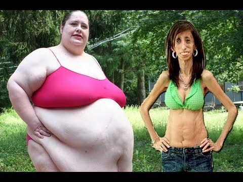 Fattest Woman & Skinniest Woman In the World