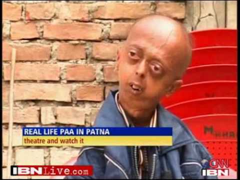 Bihar's Progeria victims want to meet Paa's Big B