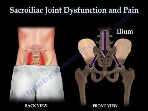 Sacroiliac Joint Dysfunction Animation - Everything You Need To Know - Dr. Nabil Ebraheim, MD