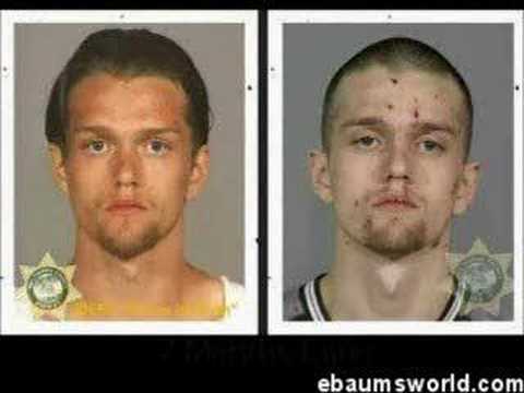 Drug abuse pictures before and after