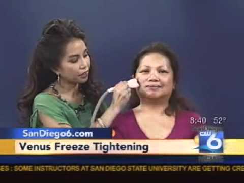 San Diego & La Jolla Dermatologist Dr. Tess Mauricio Demos Venus Freeze