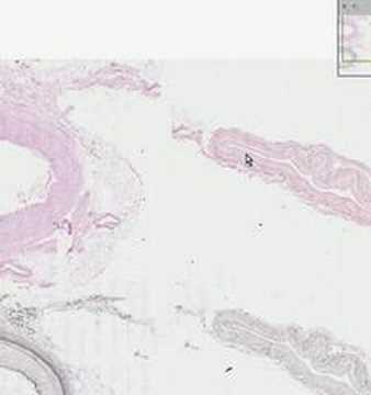 Shotgun Histology Medium Artery and Vein