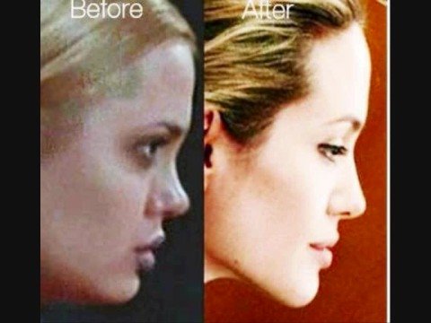 ANGELINA JOLIE BEFORE & AFTER