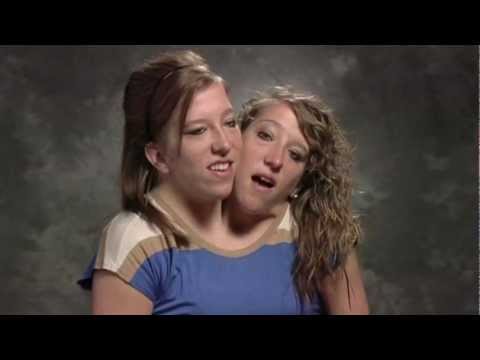 Conjoined Twins Abby and Brittany's New TLC Reality Show - The Breakdown