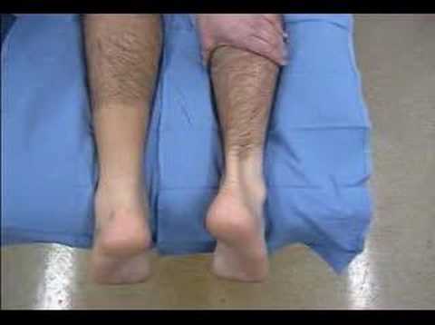 Achilles Tendon Tear Test