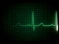 ekg (YOU CAN USE THIS VIDEO)