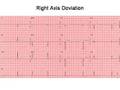 ECG Course 1