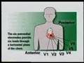 12 Lead ECG Placement Part I