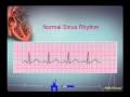 Intro EKG Interpretation Part 1