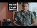 CDC: Tips from Former Smokers - Buerger's Disease Ad