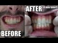 NATURAL TEETH WHITENING AT HOME... WITH TURMERIC?! #383