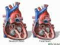 fetal heart circulation