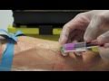 Venepuncture -  How to take blood - OSCE guide