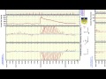 Cosmic Ray Burst. March.29.2013 - How to Find the Source