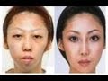 China Uncensored - Man Sues Wife Over Secret Plastic Surgery - and Wins! | NTD China Uncensored | NTDonChina